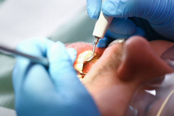 Best Emergency Dental Care for Broken or Chipped Teeth in Longview, TX