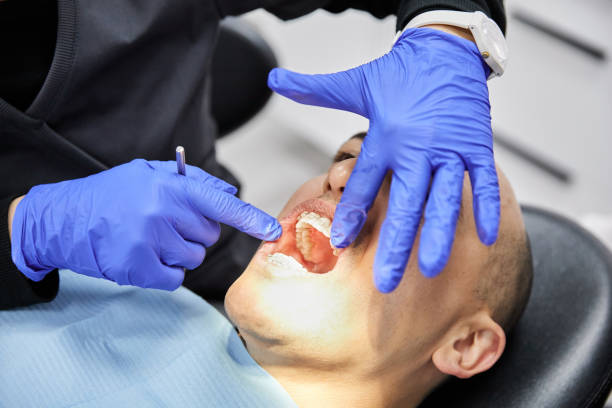 Best Emergency Treatment for Dental Infections or Abscesses in Longview, TX